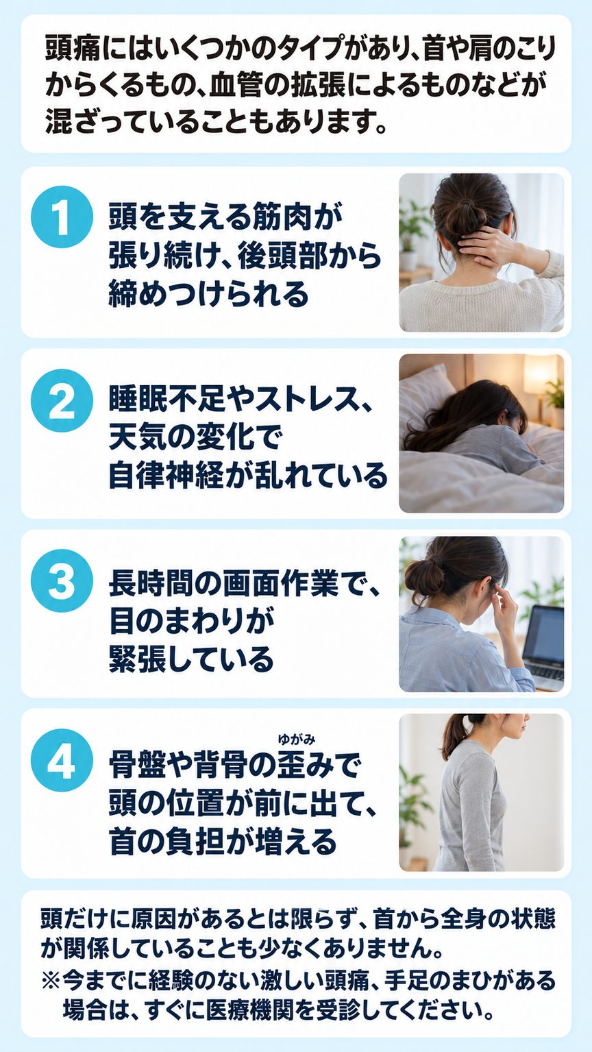 片頭痛｜片頭痛に関係する4つのこと